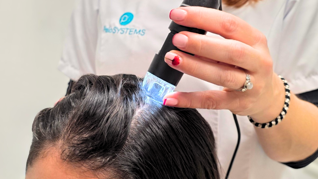 Prevenir la caída del cabello